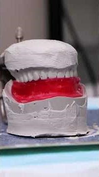 How Removable Dentures Are Made 😳