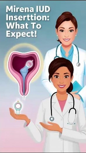 Mirena IUD Procedure Explained: Step-by-Step Guide #facts