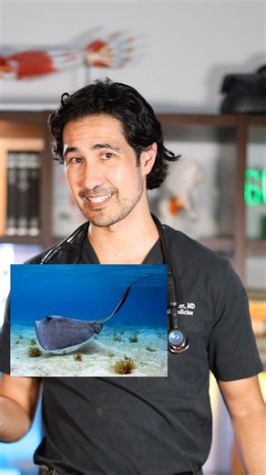 Stingray Shuffle! Doctor Explains #stingray #doctor #health