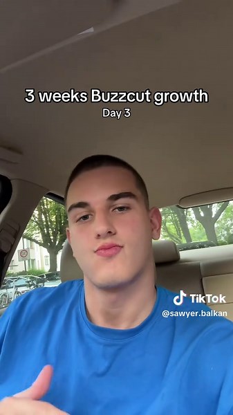 Buzzcut Growth Progress: Day 3 Update