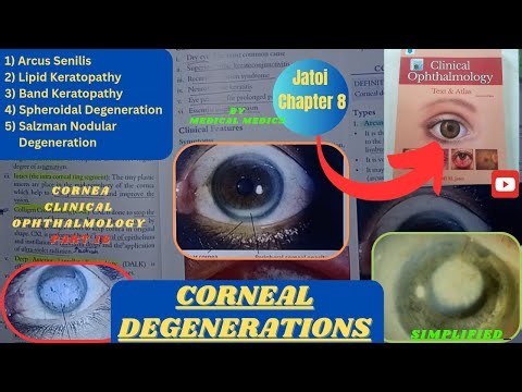 Corneal Degenerations | Jatoi Clinical Ophthalmology | Cornea Part 16