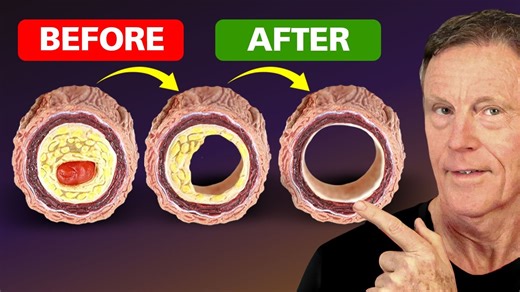 🧠💡 How to Reverse Plaque — 20 Years of Knowledge in One Video 🎥✨ Ready for your personalized care plan?: Call us Now: 859-721-1414 or visit https://prevmedhealth.com/ Get My 7- Step Heart Attack Prevention Protocol free ebook here: https://45413573.hs-sites.com/fb-ebook | Dr. Ford Brewer