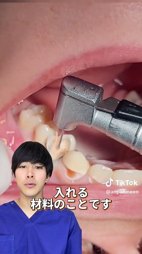 ガッタパーチャの重要性と歯科治療