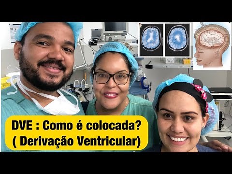 DVE: How is it placed? (Ventricular Shunt)