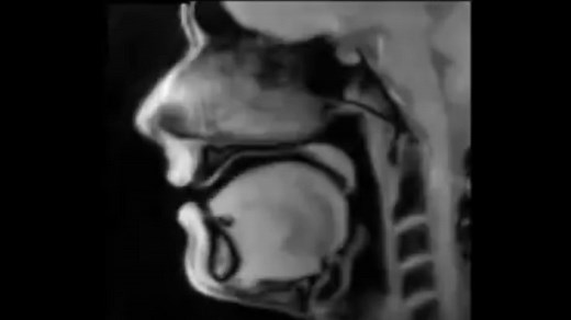 L'IRM d'un homme qui parle