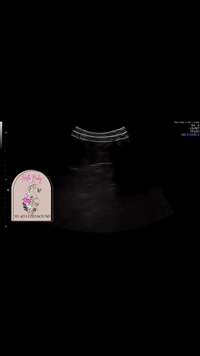 2nd trimester ultrasound #hellobaby3d4d #deerparkultrasound #momtobe #supportlocalbusiness #babylove #pregnancyjourney #pregnantmomma #pasadenatx #laportetx #houstontx #2ndtrimester | Hello Baby 3D/4D Ultrasound | Facebook
