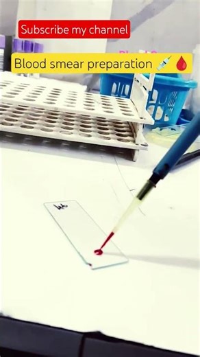 Smear Preparation on Slide 🔬 | Lab Technique Step by Step🩸 #Shorts ##trending #ytshorts