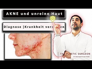 Diagnose AKNE verstehen ... | HAUT | AKNE | PICKEL | Dr. Alawi