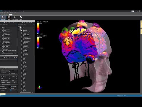 Sim4Life V6.0 Neural Sensing Package: Simulation of Neural Activity in a Branching Peripheral Nerve