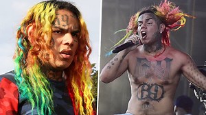 Tekashi 6ix9ine's Laser Tattoo Removal Would Take At Least A Year, Expert Reveals