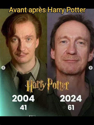 Harry Potter : Les Acteurs Avant-Après, Leur Évolution au Fil du Temps ! ✨ #harrypotter #potterhead