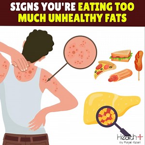 11K views · 65 reactions | Signs You're Eating Too Much Unhealthy Fats | Health+ | Facebook