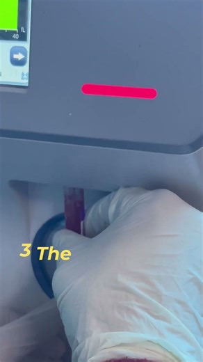 # How to perform CBC Test in Automated Cell Counter # Cell counter# MedFactswithMahi.