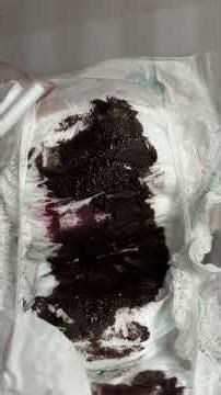 Dei iogurte para minha RN e ela não está bem… #maternidade #bebereborn