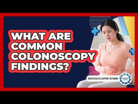 What Are Common Colonoscopy Findings?