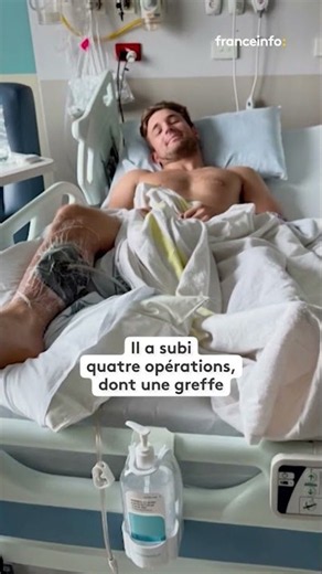 Attacked by a shark, he nearly loses his leg