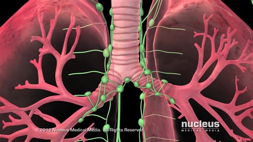 【3D演示】肺癌（原版+字幕版）