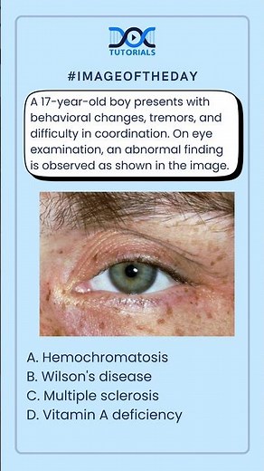 What is the most likely diagnosis?