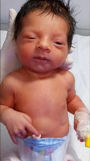 Low Birth Weight Baby NICU Care | Management, Monitoring & Supportive Care
