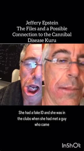 Uncovering Hidden Truths on Instagram: "Kuru belongs to a class of diseases called transmissible spongiform encephalopathies (TSEs), also called prion diseases. It primarily affects the cerebellum — the part of your brain responsible for coordination and balance. Unlike most infections or infectious agents, kuru is not caused by bacteria, viruses, or fungi. Infectious, abnormal proteins known as prions cause kuru. Prions are not living organisms and do not reproduce. They are inanimate, misshape