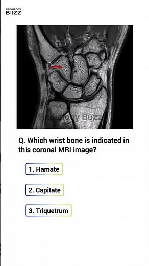 🖐️ Wrist Anatomy Quiz: Spot the Structure!🤔