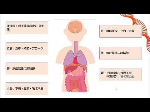 【レビュー】MALTリンパ腫【臨床的特徴】