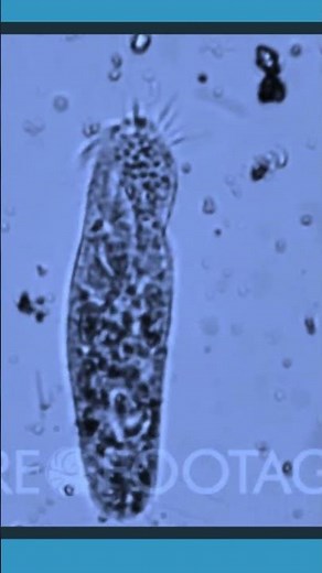 Os TIPOS de Protozoários são esses #biomedicina #ciencia #protozoários #bio #proto #microbiology