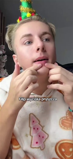 Filip wyciska pryszcza – Zabawne momenty