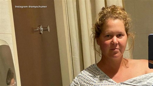 Amy Schumer talks about getting her strength back after endometriosis and plastic surgery