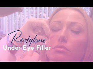 Restylane Under Eye Filler | Total Dermatology
