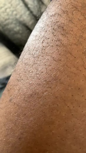 Understanding Leg Twitching: Causes and Concerns