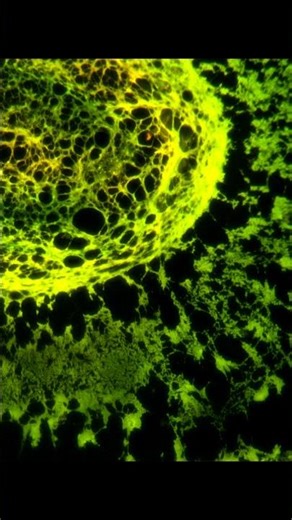 fluorescence microscopy #microscope #fluorescence