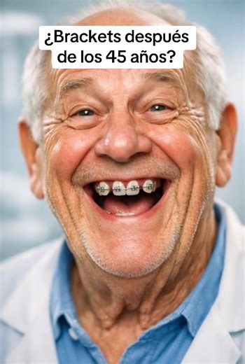 ¿Brackets después de los 45 años? —Peor sería quedarme con los dientes chuecos toda la vida. 😅 Cada vez más adultos deciden comenzar su tratamiento de ortodoncia. No es solo estética: también ayuda a mejorar la mordida y la salud de los dientes. Porque una sonrisa bien alineada no tiene fecha de caducidad. Ortodoncia para adultos en San Pedro Garza García NL México 🇲🇽 #ortodonciaensanpedrogarza #ortodonciainvisible #ortodonciaadultos #brackets