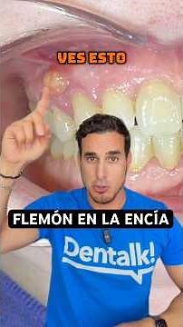 How to treat a DENTAL ABSCESS 😱 The mistake that can make the infection worse