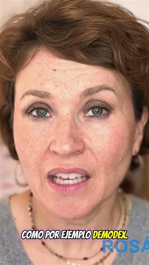 ¿Por qué tienes Rosácea?