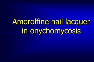 Amorolfine nail lacquer in onychomycosis - SlideServe