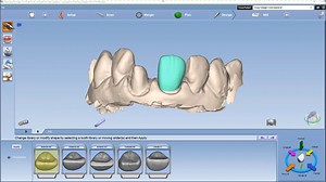 Contralateral Copy from Design (Mirroring)