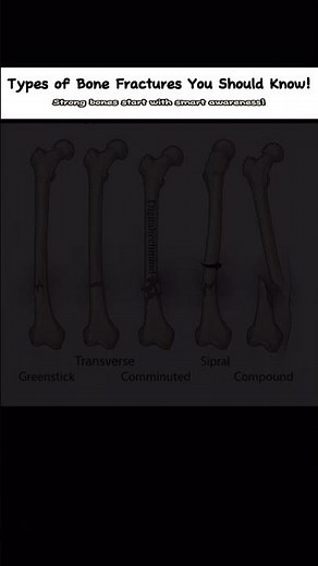 #tutorialfilter 🦴