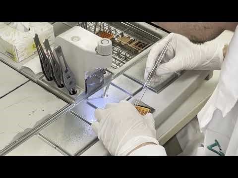 From Tissue Sample to Final Diagnosis by MyPathologyReport