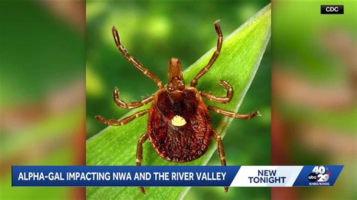 Local Alpha-gal experts speaks to 40/29 News