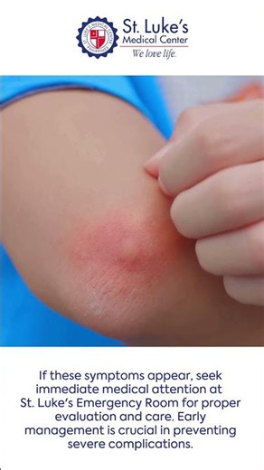 Is it just a fever... or Dengue?