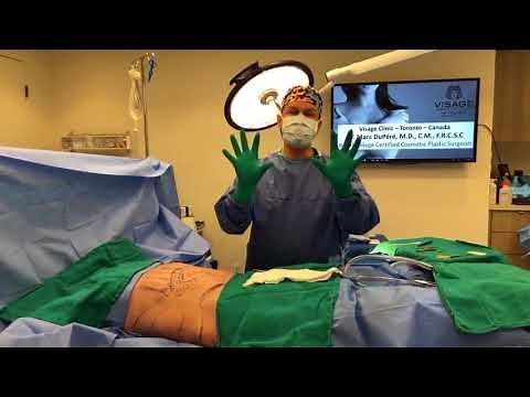 Dr. DuPéré LIVE Surgery: Fat Grafting, Buttock Augmentation