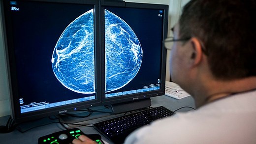 What your mammogram can tell you about your cardiovascular health