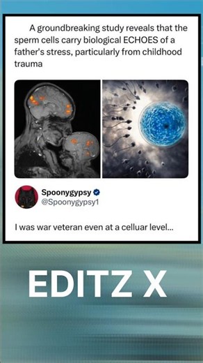 When Science Gives You Main Character Energy 😂 | Viral Trauma Meme#memes #funnymeme #shorts