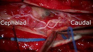 SPINE23-1284 Video 2