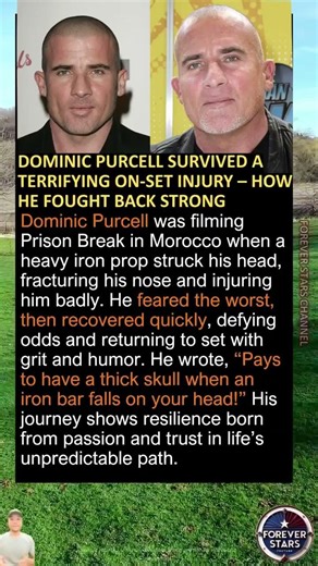 Dominic Purcell Survived a Terrifying On-Set Injury – How He Fought Back Strong