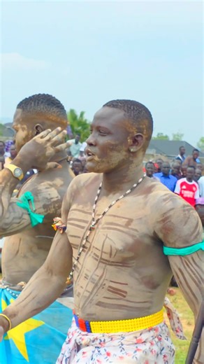 35K views · 486 reactions | Quickest recovery to Lueth Makuol who suffered severe shoulder dislocation injury this evening at APT wrestling ground, a bad one for ambitious rising star who now joins Magoro on the sideline  | Jonglei Daily Mail | Facebook