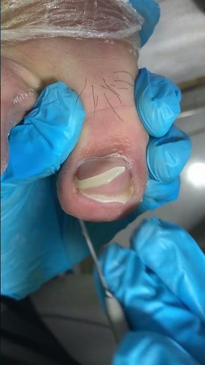 Clean toenails, daily care~ #satisfying #nails #pedicure