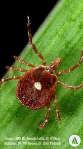 Alpha-gal syndrome is a rare, recently discovered form of allergy to red meat that can be caused by a bite from a lone star tick. Learn more: https://mrkmnls.co/3xUDdQf | Merck Manual Consumer