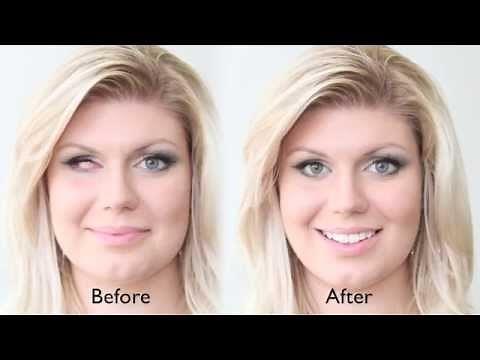 Prosthetic Eye Patient Taylor's Story | Ocular Prosthetics, Inc.